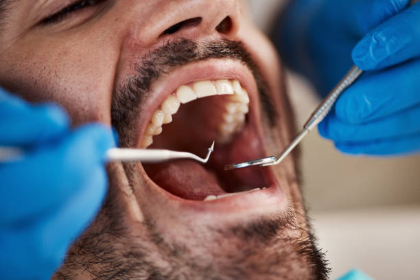 Best Emergency Broken Tooth Repair in Westfield, PA
